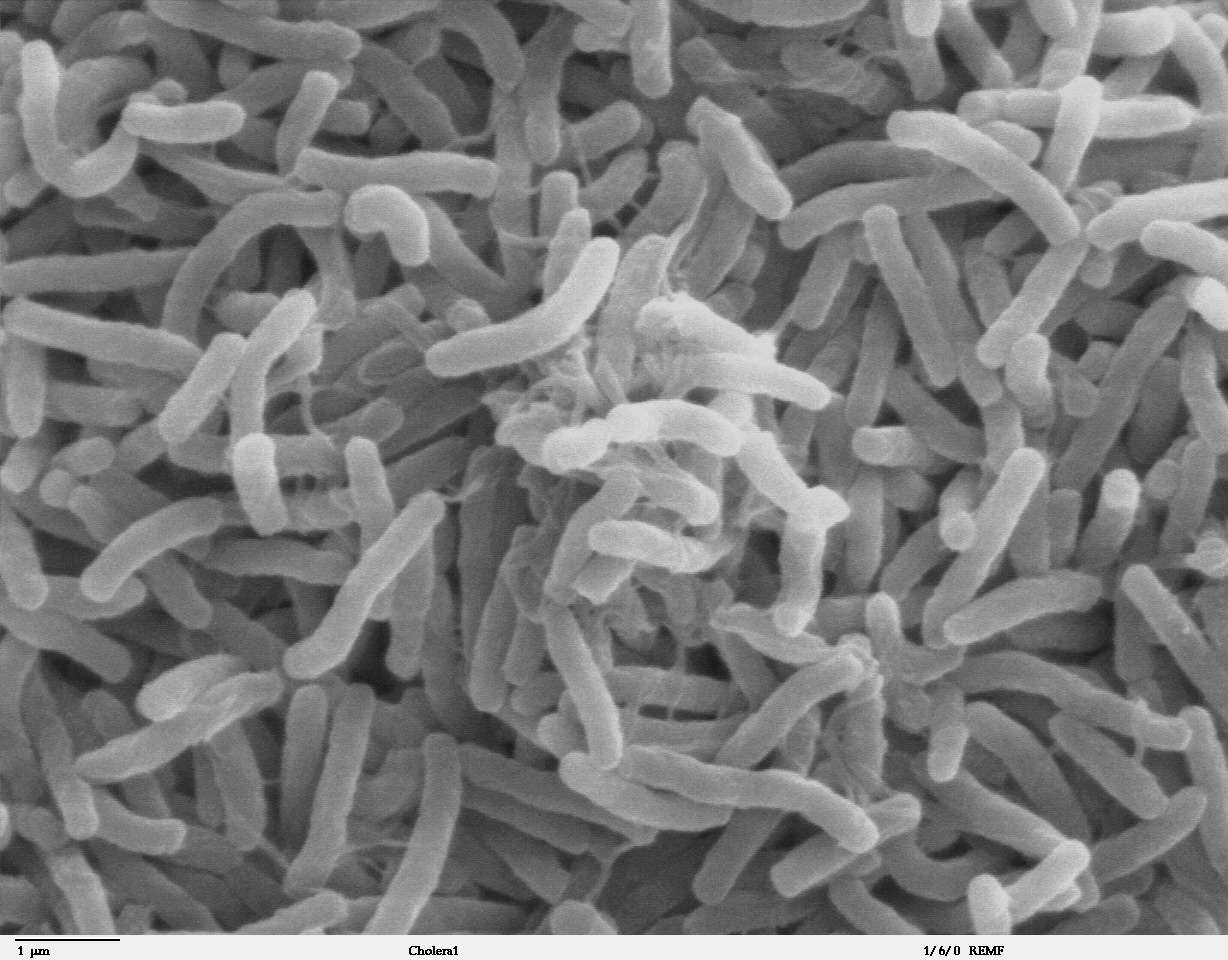 http://medicinsk.net/wp-content/uploads/2020/11/Cholera_bacteria_SEM.jpg