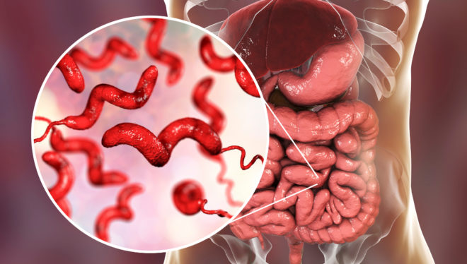 Campylobacter-infektion: symtom och behandling