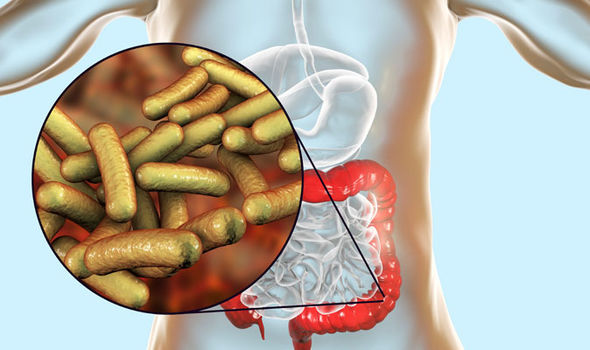 Shigella-symtom: Bakteriell infektion i magen