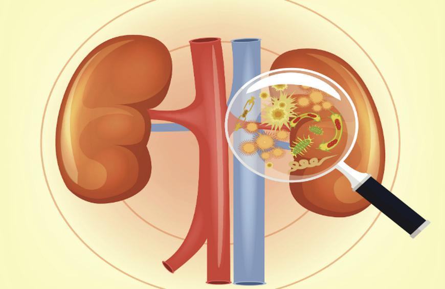 Njurinfektion: symtom, orsaker och behandling