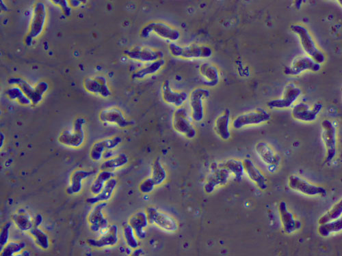 Naegleria fowleri-infektion (hjärnätande amoeba)