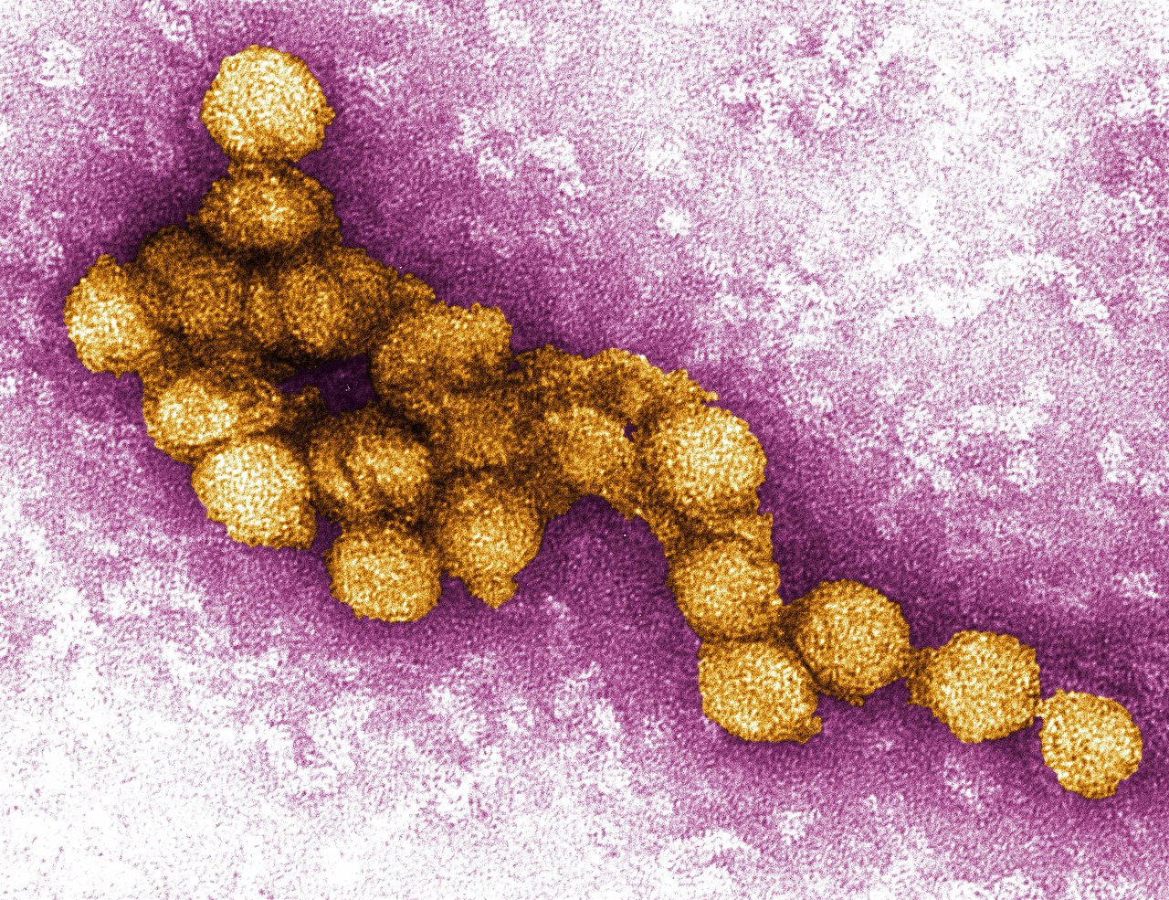 West Nile-virus: symtom och behandling