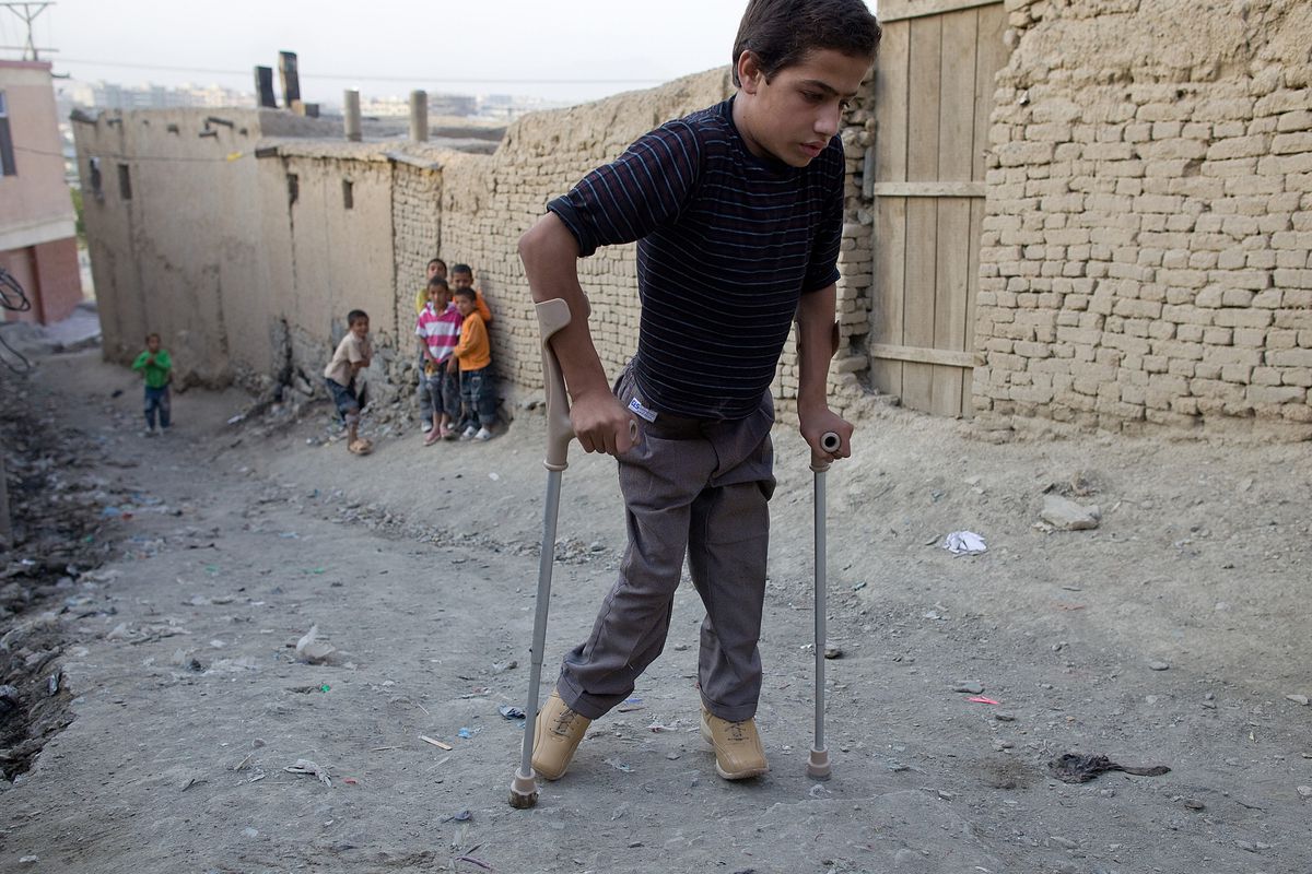 Polio: orsaker, symtom och behandling