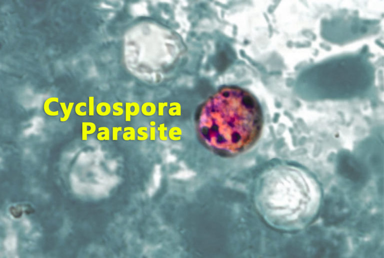 Cyclospora-infektion: symtom, orsaker och behandling