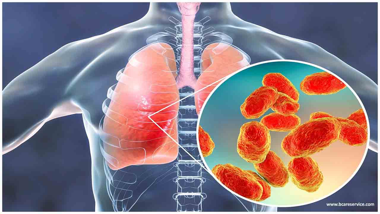 Bakteriell lunginflammation: symptom och behandling