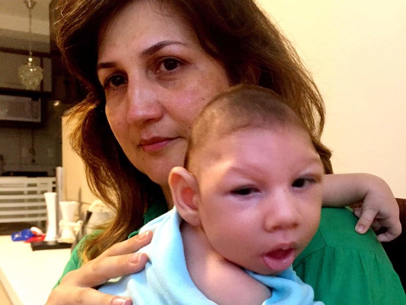 Marilla Lima, en brasiliansk mamma, hade Zika-virus medan hon var gravid.  Hennes 2,5 månader gamla son, Arthur, har mikrocefali - en fosterskada som kännetecknas av ett litet huvud och allvarlig hjärnskada. 